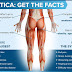 How to Cure Sciatica at Home?