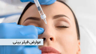 Nasal filler side effects