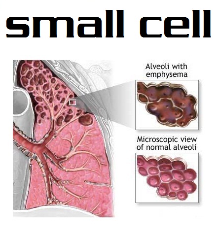 breast most cancers metastasis to endometrium