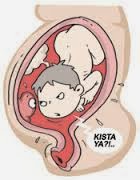 http://obatsinusitisakut.blogspot.com/2013/12/obat-kista-untuk-ibu-hamil.html