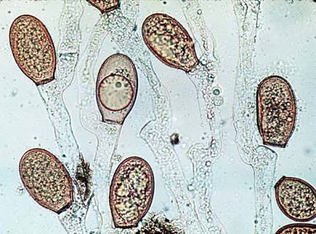 Chytrids structure