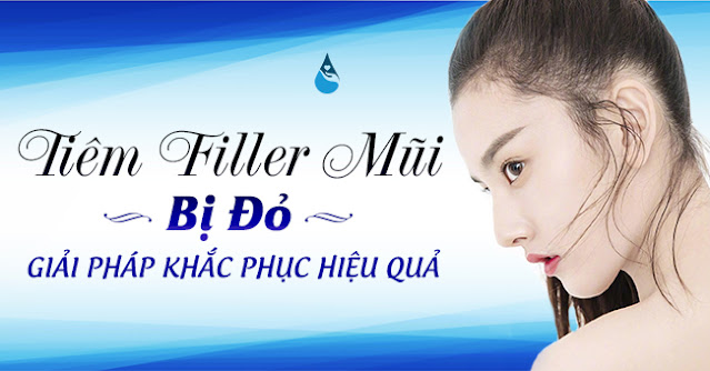 tiêm filler mũi bị sưng đỏ