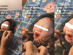 Viral Bayi Masih Merah Ditusuk Pensil Diduga demi Bentuk Lesung Pipi, Ekspresi Sakit Bikin Publik Geram