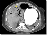 pemeriksaan radiology pemeriksaan radiology perut