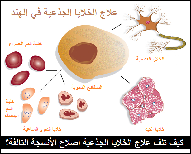 كيف تلف علاج الخلايا الجذعية إصلاح الأنسجة التالفة؟