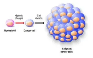 تنقسم الخلايا السرطانية إلى أورام حميدة و خبيثة