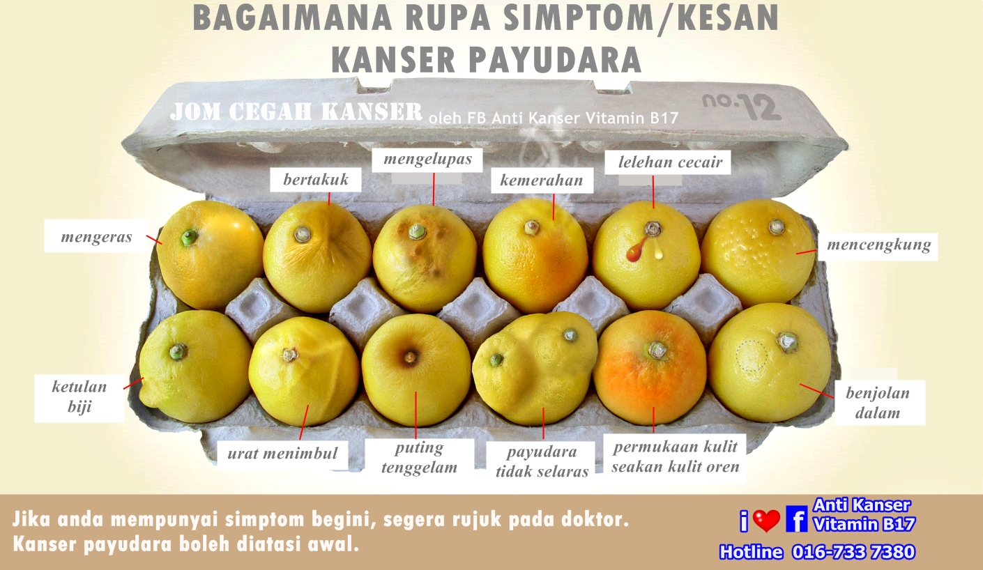 InfoKanserPayudara: April 2013