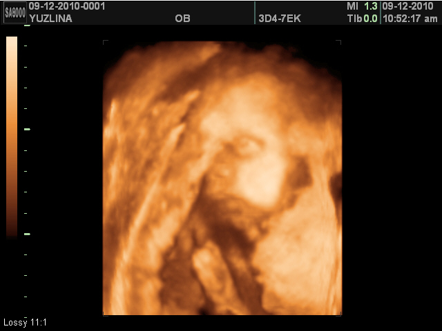 TheWhiteCoffee: ~ 31 weeks pregnancy - updated