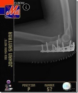 Johan Santana's Player Card