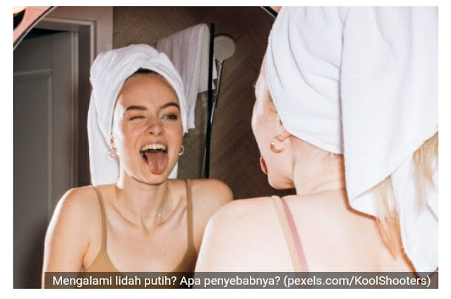 Penyebab lidah putih