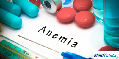 Understanding Anemia: Causes, Symptoms, and Treatment