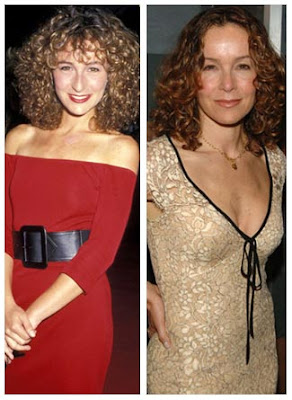 jennifer grey  plastic surgery