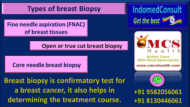 Breast cancer awareness, Best Indian breast cancer doctors, Best Indian hospitals for breast cancer treatment.