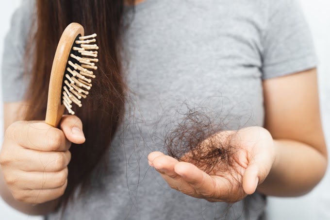 How to Get Rid of Dandruff Naturally | 15 Home Remedies to Get Rid of Dandruff Naturally