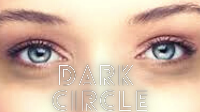 How to Get Rid of  Dark Circles,  Causes    & Treatment