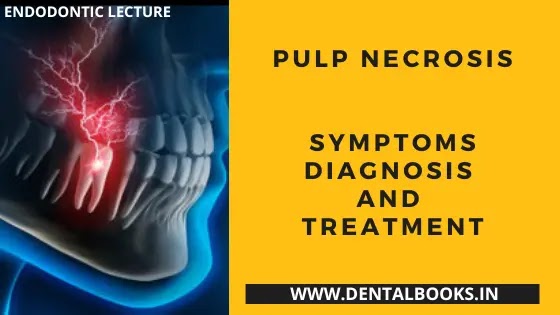 Pulp Necrosis | Endodontic Lecture | Dental Notes