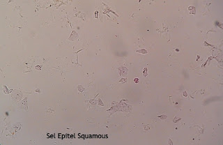 Sel Epitel Squamous.