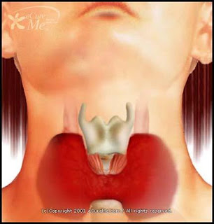 Tiroiditis