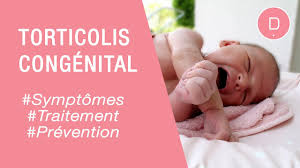 Maladies infantiles | Torticolis congénital et plagiocéphalie