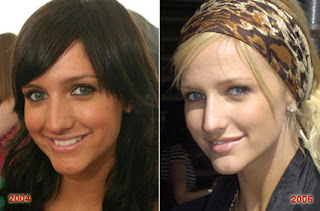 Ashlee Simpson Nose Job