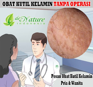 Menghilangkan kutil pada kemaluan, obat kutil kelamin atau kutil di kemaluan oles, kutil dekat kemaluan, obat kutil kelamin atau kutil di kemaluan beli di apotik, cara penyembuhan kutil kemaluan secara alami, obat kutil kelamin manjur, obat kutil kelamin atau kutil di kemaluan dr tumbuhan, obat kutil kelamin atau kutil di kemaluan yang dijual di apotek, cara mengobati kutil di kelamin, obat kutil kelamin atau kutil di kemaluan dijual di apotik, obat tradisional kutil kelamin dan kutil kelamin