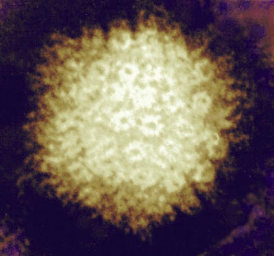 varicella-zoster virus