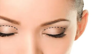 Blepharoplasty - all you need to know