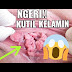 Terlengkap !!! Daftar obat kutil kelamin paling ampuh