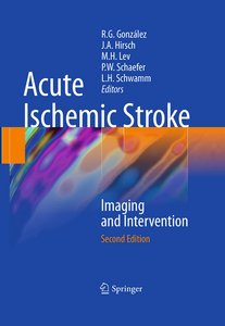 Acute Ischemic Stroke: Imaging