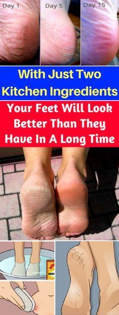 With Just Two Kitchen Ingredients, Your Feet Will Look Better Than They Have In A Long Time