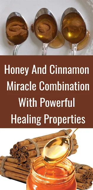 Honey And Cinnamon – Miracle Combination With Powerful Healing Properties