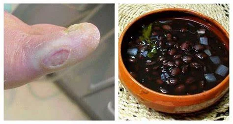 This Amazing Ancient Recipe Can Cure Diabetes, And Pharmacies Have Spent Millions Of Dollars To Make It Dissapear!
