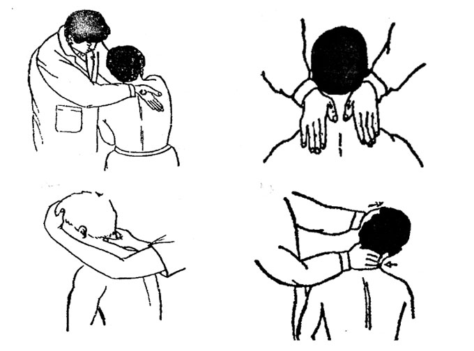 CERVICAL SPONDYLOSIS (SAKIT TULANG LEHER)