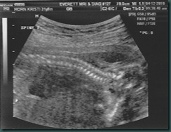 ultrasound_0004