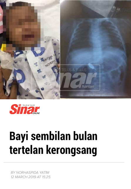 Bayi 9 Bulan Tertelan Kerongsang