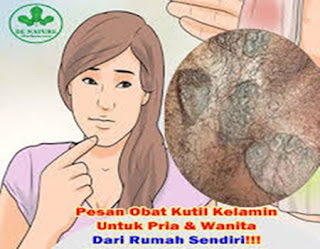 Obat tradisional kutil di kemaluan, penyebab kutil d kemaluan, gambar kutil kelamin atau kutil di kemaluan kesehatan, obat kutil kelamin atau kutil di kemaluan alami untuk ibu menyusui, mengobati kutil kelamin dengan bawang putih, pengobatan kutil kemaluan pada wanita, cara menghilangkan kutil kelamin dengan cuka, menghilangkan kutil kelamin, obat kutil kelamin atau kutil di kemaluan tradisional yang aman untuk ibu menyusui, obat alami untuk kutil kelamin, cara menghilangkan kutil kelamin atau kutil di kemaluan secara alami