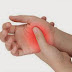 Definition of Inflammatory