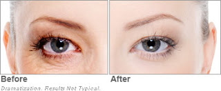 Can't Fix Dark Circles and Puffy Eyes,