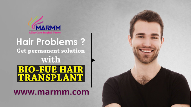 Hair transplant in Indore