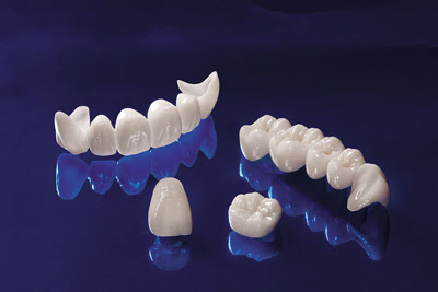 Răng toàn sứ venus có tác dụng gì ?