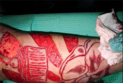 Weird Skin Burning Tattoos | painful Tattoos