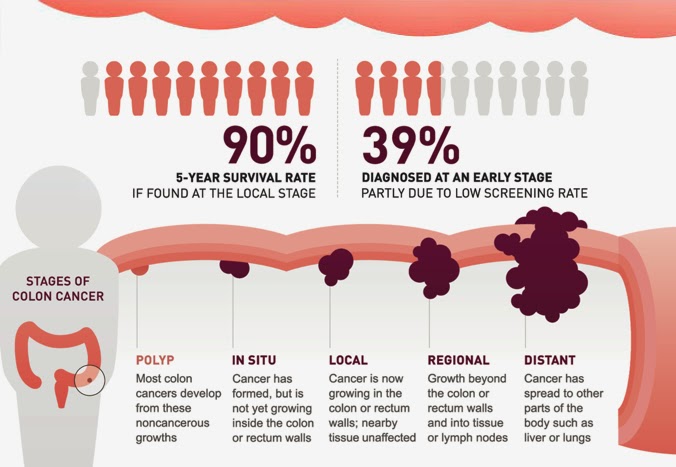 The Health Website : Bowel (Colon / Colorectal) Cancer