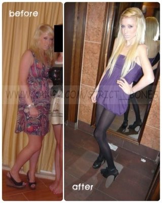 before and after thinspo real girl