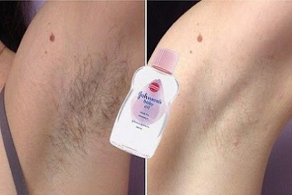 Remove Unwanted Hair Permanently In Three Days , No Shave No Wax, Removal Facial & Body Hair