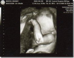Sono30Weeks