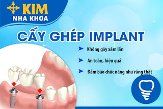 quy trình cấy ghép răng implant