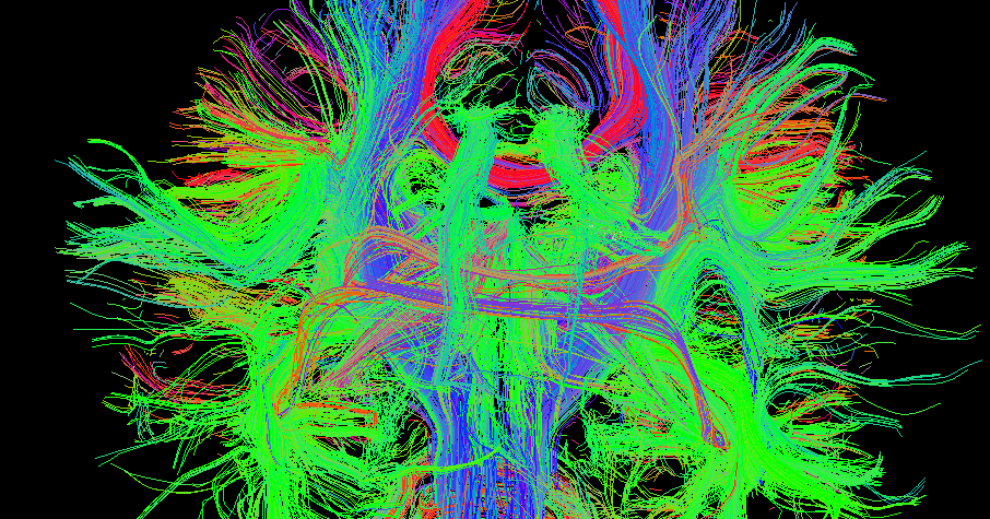 Diffusion Tensor Imaging 101 Diffusion Imaging; Introduction