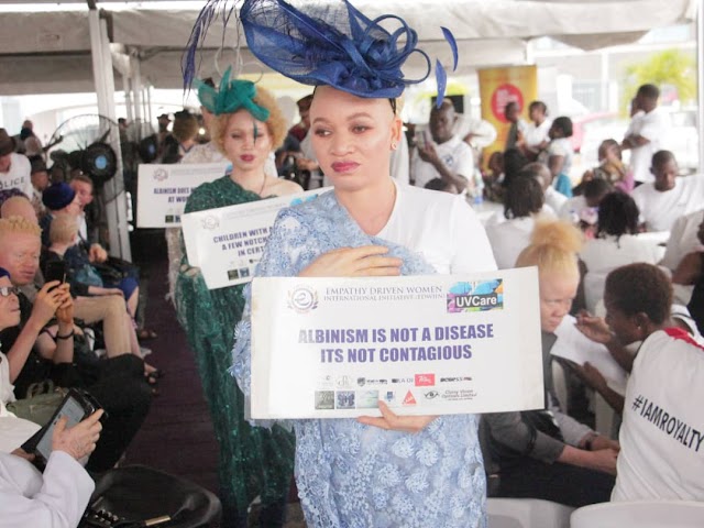  EDWIIN CONVENES PERSON WITH ALBINISM, OFFERS FREE MEDICAL CARE