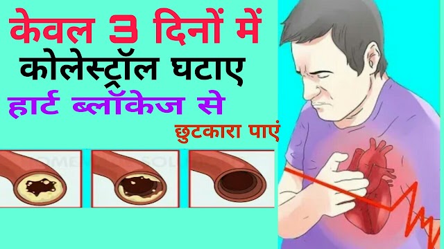 कोलेस्ट्रॉल कम करने के घरेलू उपचार | cholesterol kam karne ke upay in hindi