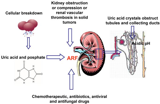 September Antecedent Words Hazardous Drugs Chemotherapy Cytotoxic Drugs Occupational Exposure Safe Doing Precautions Antineoplastic Agents Nurse 